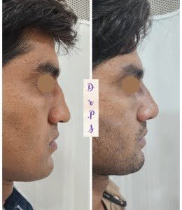 (Think about a Glow up arc ) 